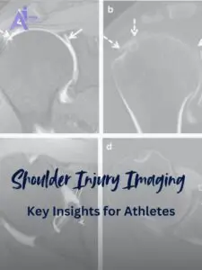 MRI & Arthrography for Shoulder Dislocation
