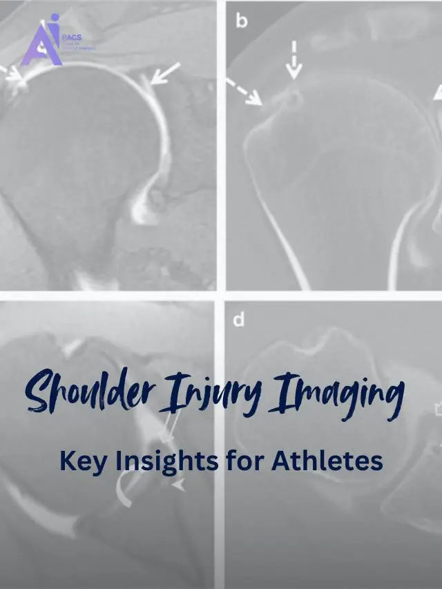 MRI & Arthrography for Shoulder Dislocation