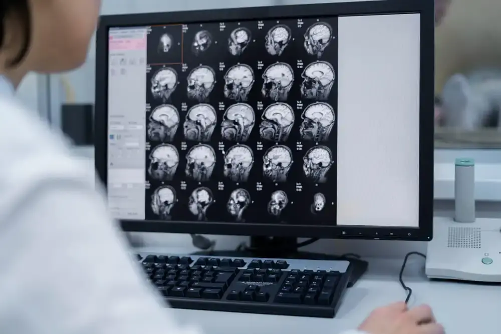 Radiologist checking MRI images during scanning process, highlighting need for detailed analysis and second opinion