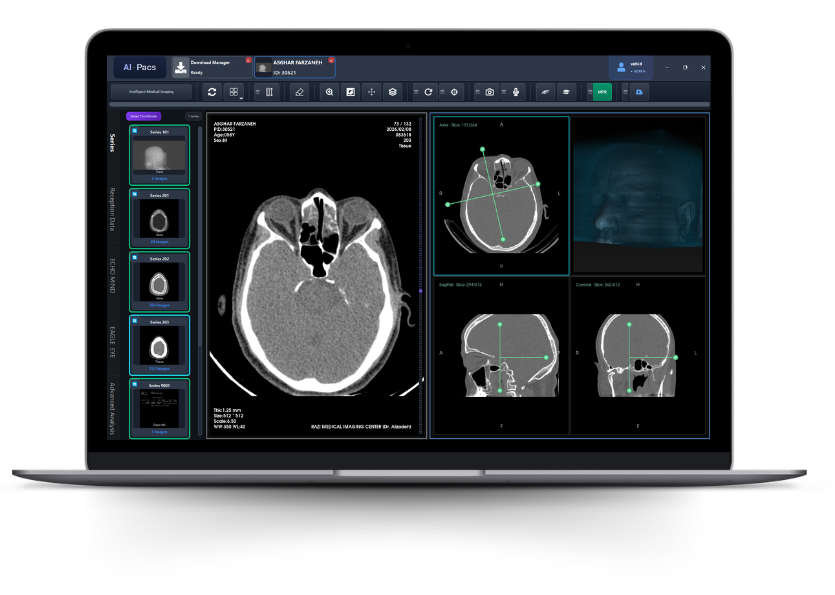 AI-PACS Enhancing Medical Imaging with Precision and Expertise