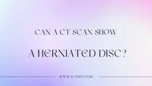 Can a CT Scan Show a Herniated Disc