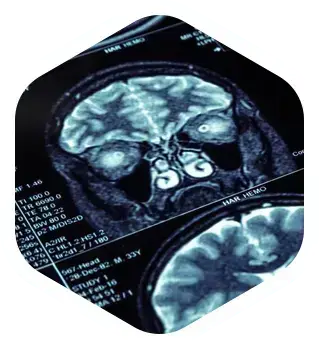 brain ct